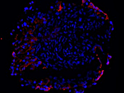 CYTOKERATIN 7
(WHOLE MOUNT)