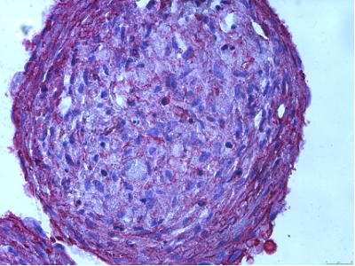 ⍺Smooth Muscle Actin 
(PARAFFIN)